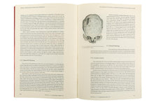 Suplemento 11 - O Arqueólogo Português. Life and Death at Torre de Palma. Two Millenia of Rural Life in the Alto Alentejo, Portugal